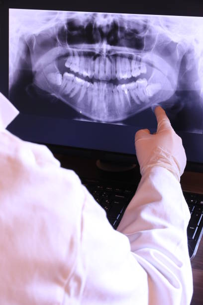 Best Emergency Tooth Extraction in Cane Savannah, SC