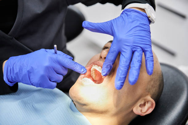 Best Emergency Tooth Extraction in Cane Savannah, SC